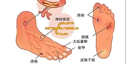 打響肢體保衛(wèi)戰(zhàn)！